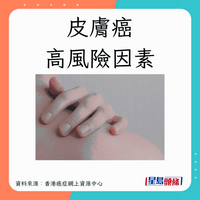 SKINCANCER_A01 SKINCANCER_A01