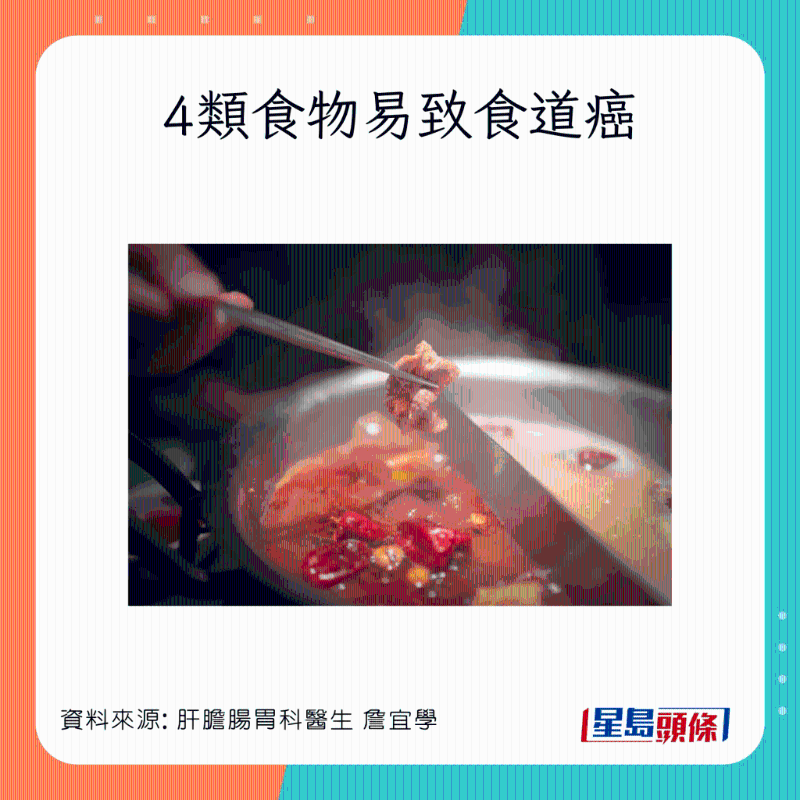 4類食物易致食道癌：火鍋