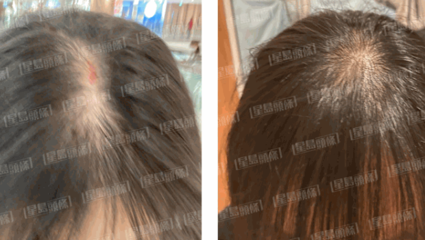 治療過程 治療過程