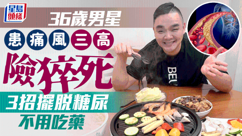 36歲男星患痛風三高險猝死，不用吃藥3招擺脫糖尿