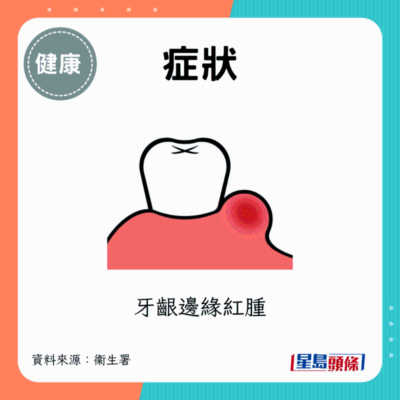 牙齦邊緣紅腫 牙齦邊緣紅腫