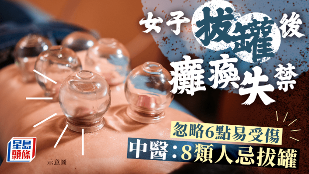 女子拔罐后癱瘓失禁 女子拔罐后癱瘓失禁