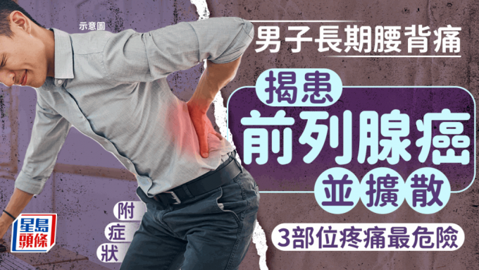 前列腺癌 前列腺癌