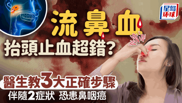 流鼻血 流鼻血