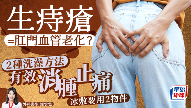 生痔瘡 生痔瘡