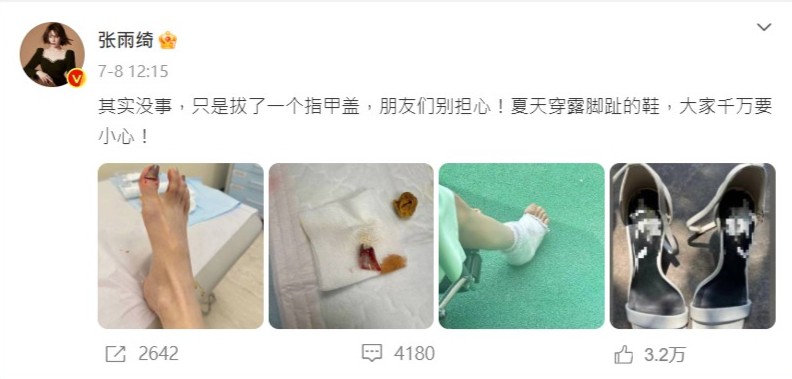 “星女郎”張雨綺坐輪椅代步3 “星女郎”張雨綺坐輪椅代步3