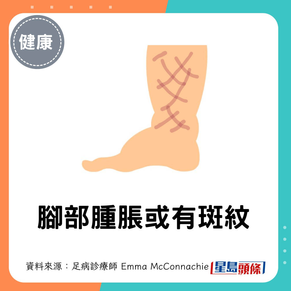 1. 腳部腫脹或有斑紋 1. 腳部腫脹或有斑紋