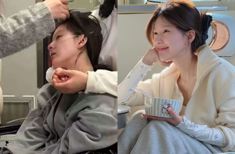 對比之前病倒、插管的樣貌，趙露思氣色好轉許多。（圖／趙露思IG）