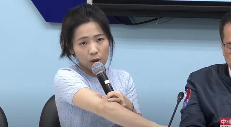 國民黨立委徐巧芯秀傷痕照。（取自直播）
