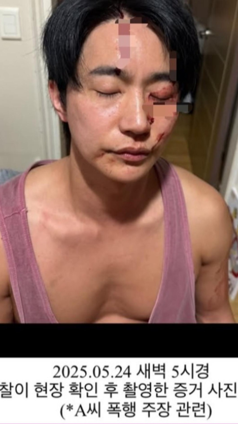 全浩俊曬出鼻青臉腫的照片回應。 （TVBS新聞網圖片）